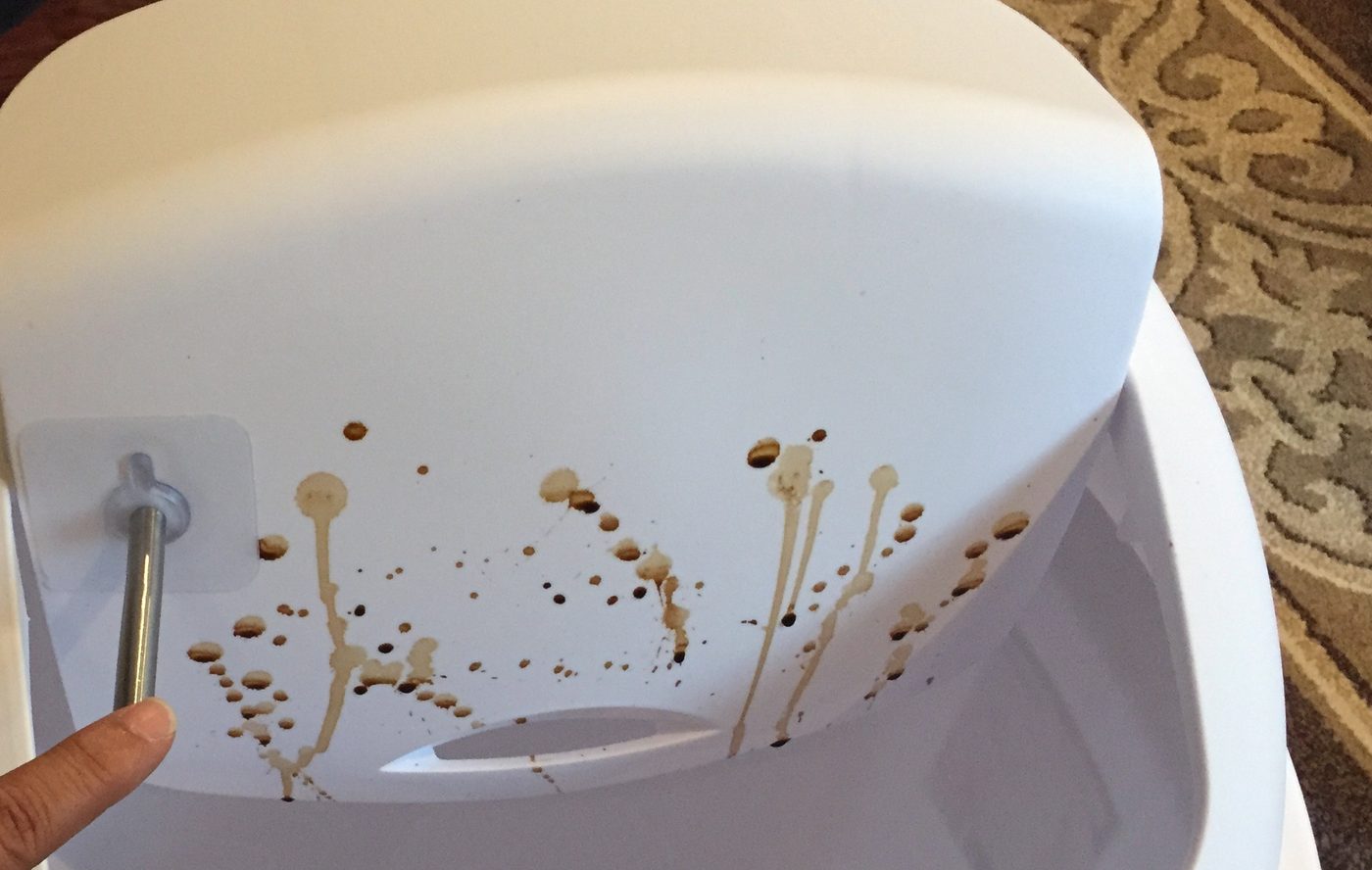 Elderly Hygiene: The Underrated Hazard of Trash Can Lids